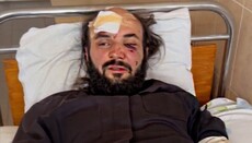 Beaten priest in Chernivtsi to Bartholomew: Our blood is on your conscience